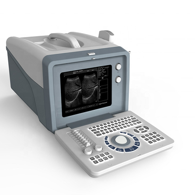 Ultrasound laptop diagnostic ultrasound machine /black and white ultrasound scanner with 15 inch LCD screen