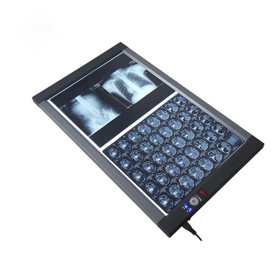 Metal CE/ISO Approved Hospital Medical Radiography Dual Panel Led X Ray Film Viewer