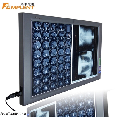 Super Bright Digital Dual General Film Medical Negatoscope LED X Ray Viewer